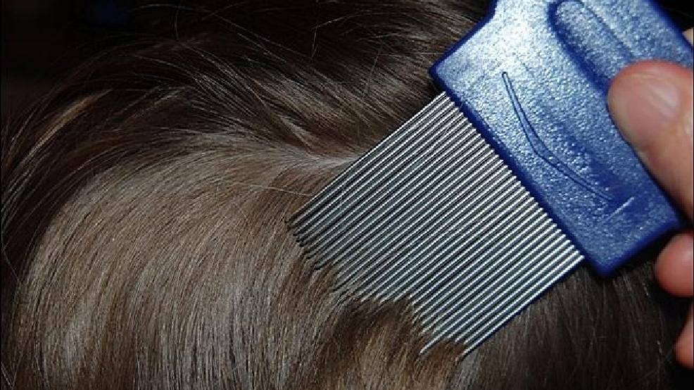 More Lenient School Lice Policies Bug Some Parents Komo